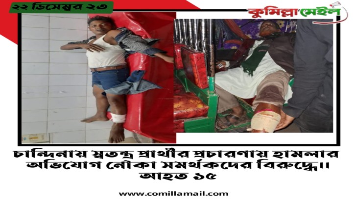 চান্দিনায় স্বতন্ত্র প্রার্থীর প্রচারণায় হামলার  অভিযোগ নৌকা সমর্থকদের বিরুদ্ধে।। আহত ১৫